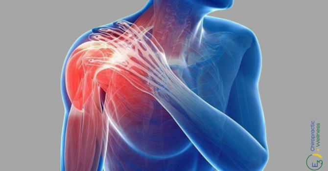 2 Exercises To Limit Shoulder Pain Due To Working Out image